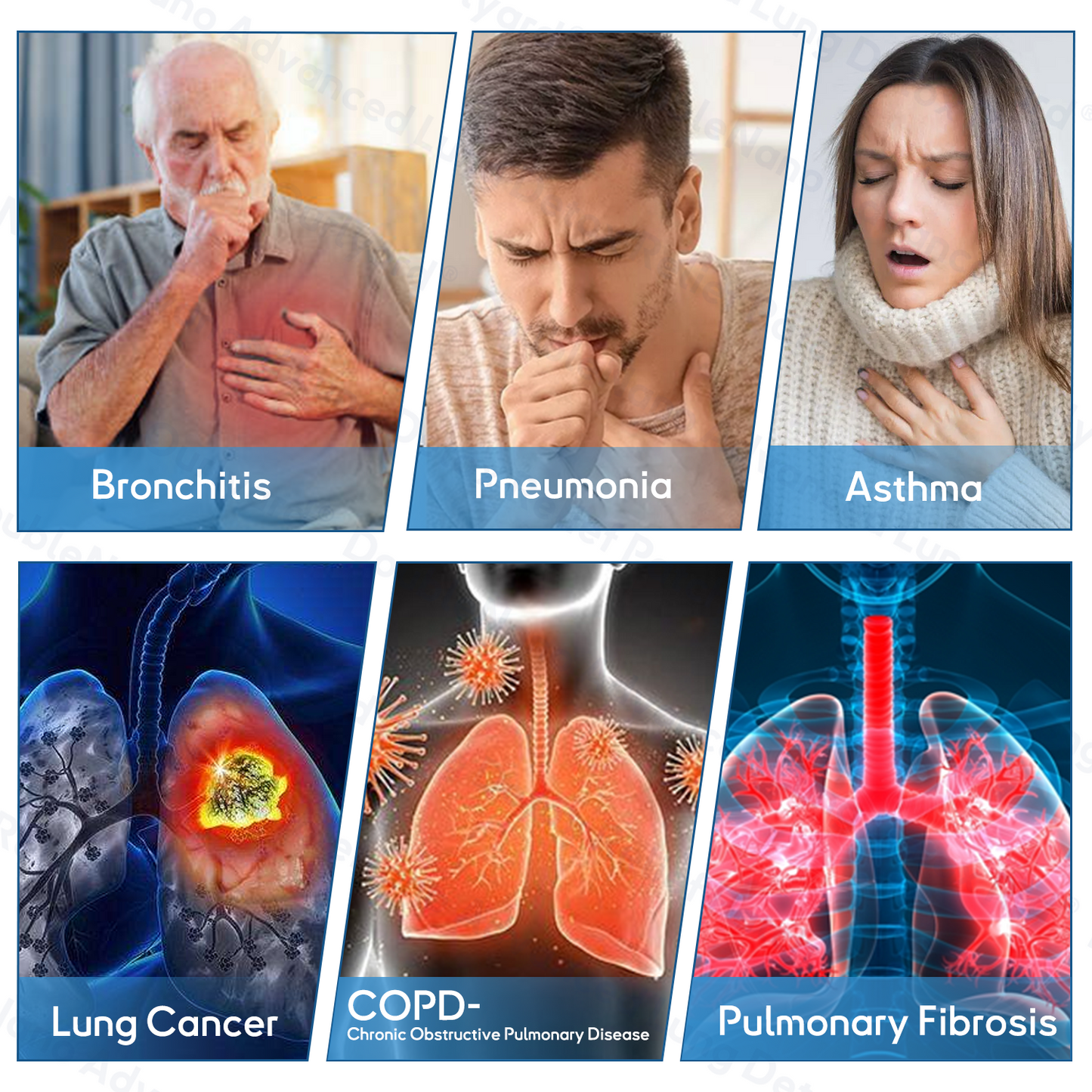 😽✨𝐎𝐟𝐟𝐢𝐜𝐢𝐚𝐥 𝐒𝐭𝐨𝐫𝐞:ClearLungX™ 𝐃𝐨𝐮𝐛𝐥𝐞𝐍𝐚𝐧𝐨 𝐀𝐝𝐯𝐚𝐧𝐜𝐞𝐝 𝐋𝐮𝐧𝐠 𝐃𝐞𝐭𝐨𝐱 𝐑𝐞𝐥𝐢𝐞𝐟 𝐏𝐚𝐭𝐜𝐡✨𝐅𝐃𝐀 𝐀𝐩𝐩𝐫𝐨𝐯𝐞𝐝