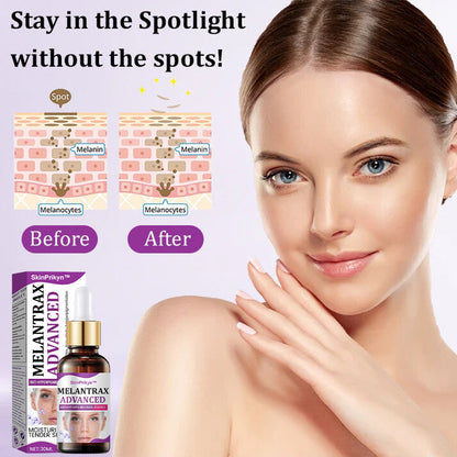 SkinPrikyn™ MelantraX Advanced Anti-Hyperpigmentation Essence
