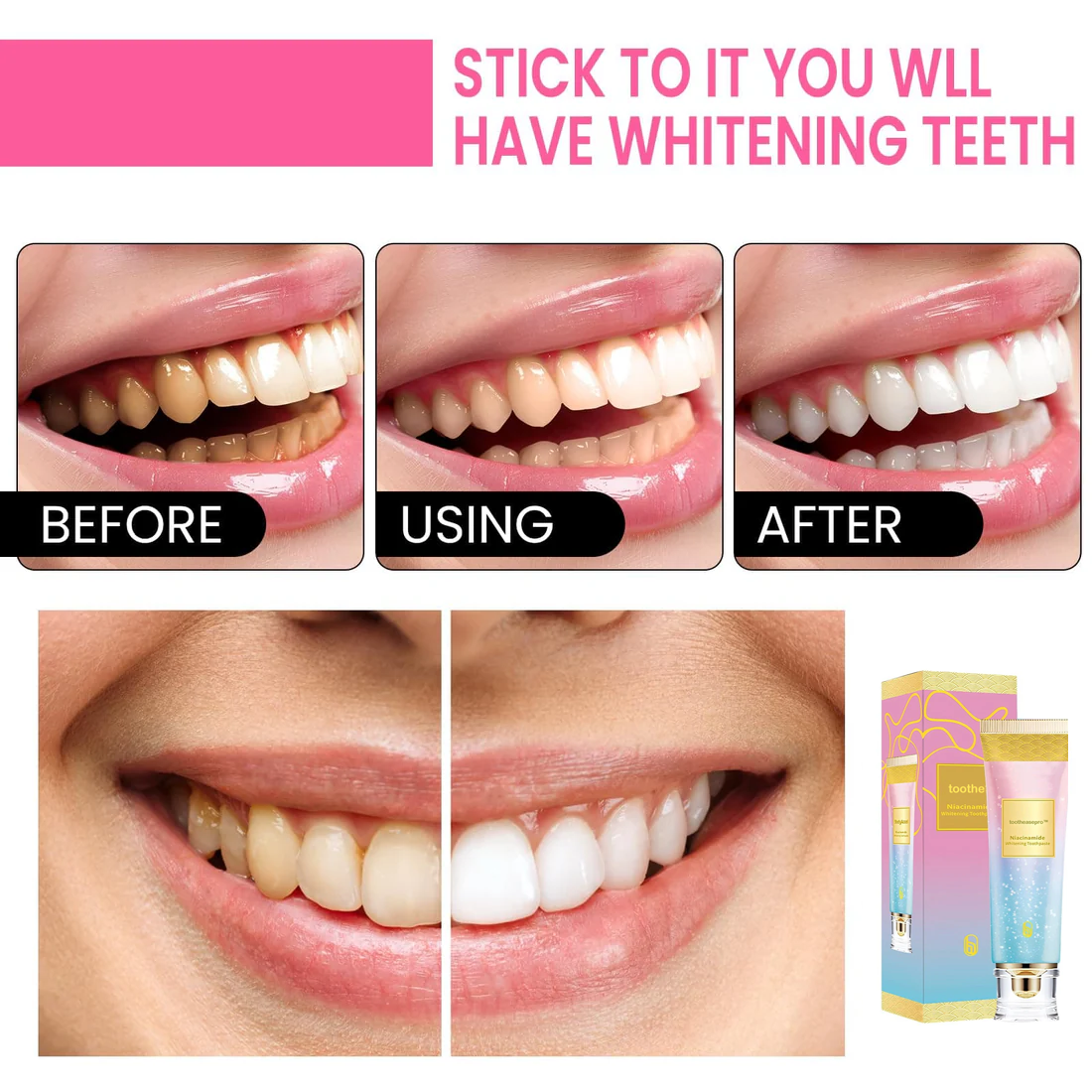 ToothEasePro™ Niacinamide Whitening Toothpaste💖
