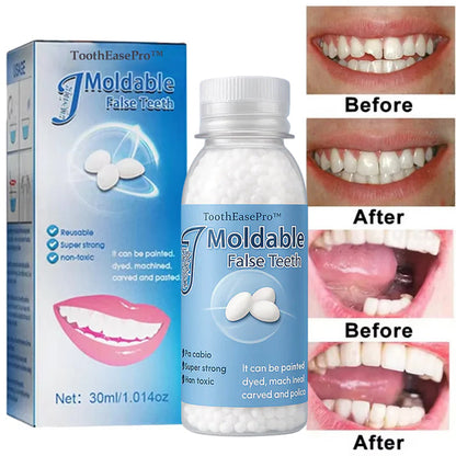 🦷 ToothEasePro™ Dental Filling Gel – Pain-Free, Drill-Free Cavity Solution💖💖